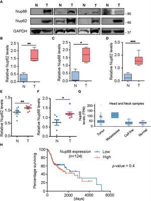 Overexpressed Nup88 stabilized through interaction with Nup62 promotes NF-κB dependent pathways in cancer